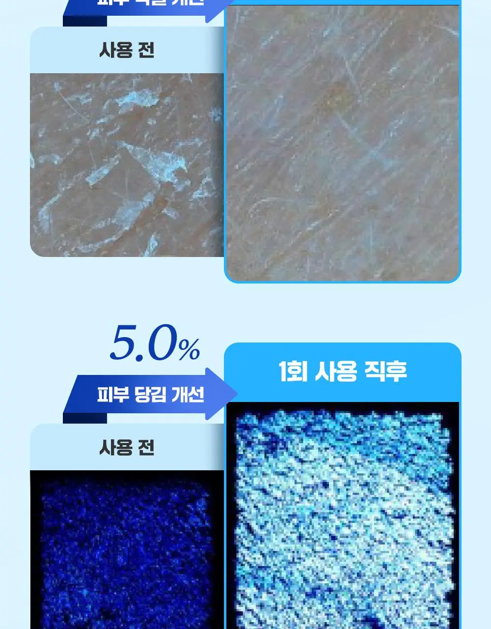 [단독기획/수분충전템] 파티온 포도당 하이드로 크림 60ml 기획(+10ml) 상세페이지 11